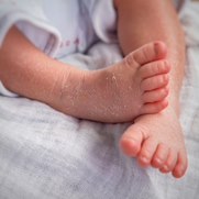 know about newborn dry skin
